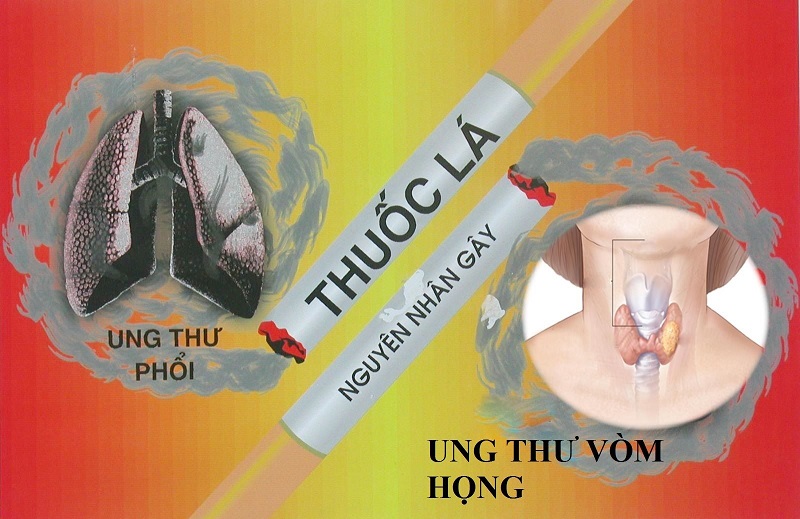 Các sản phẩm thuốc lá hút (thuốc lá điếu, xì gà, tẩu) là một yếu tố nguy cơ quan trọng đối với sự phát triển của ung thư đầu và cổ.